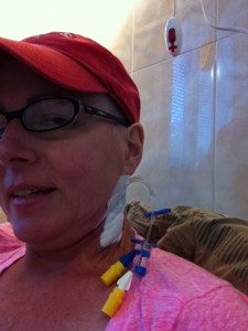 Here is what Marvin looks like, in my neck. Three lines to the outside.